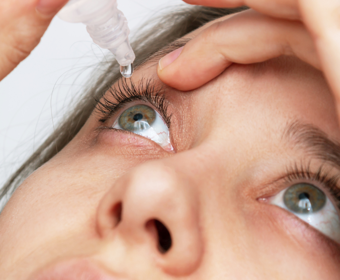 personne aux yeux verts qui a l'oeil sec et qui se traite avec des gouttes