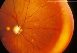 Image de fond de l'article "Observatoire"