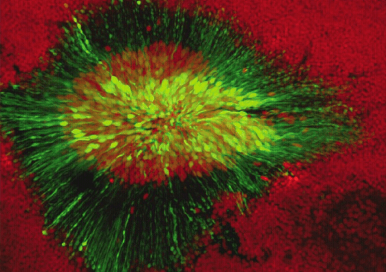 Image de fond de l'article "Observatoire"