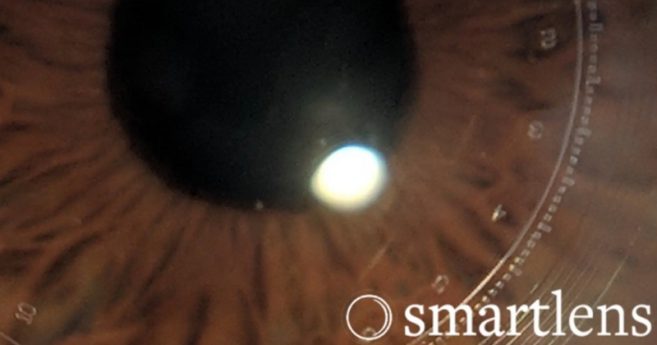 Image de fond de l'article "Observatoire"